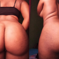 Endowed Babe With Fat Ass Post Nudes