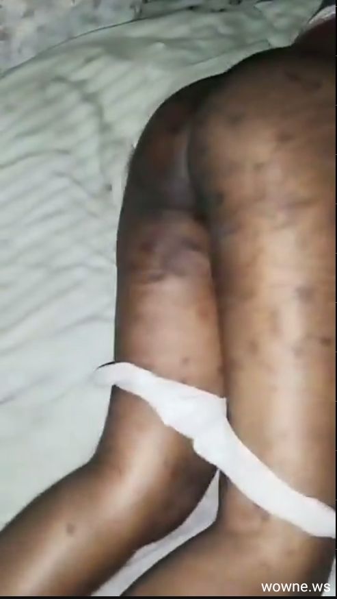 Edo Boy Records Infected Ass Of Lagos Ashawo With Big Ass (18+)